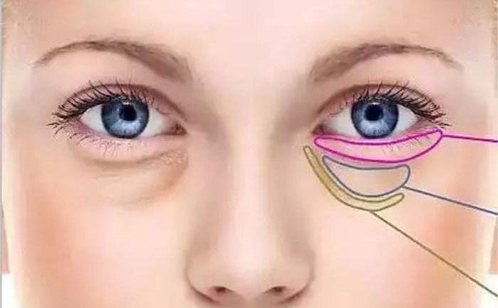 臥蠶跟眼袋怎么區(qū)分？臥蠶和眼袋有什么區(qū)別？