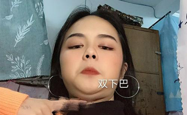 吸脂去雙下巴和溶脂瘦下巴有什么區(qū)別？