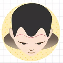 三級(jí)脫發(fā)