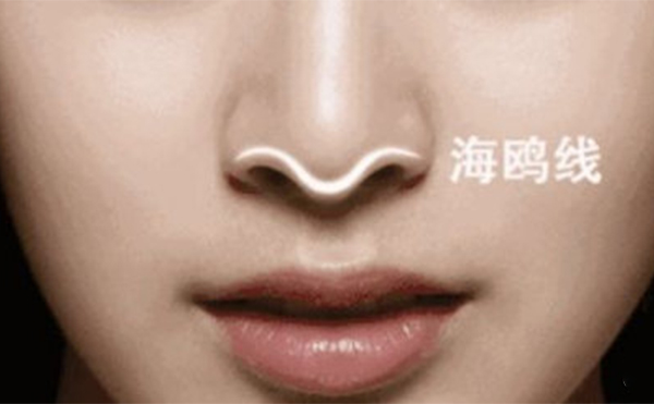 僅僅是對假體的形狀不滿意可以直接把原來的假體修好再放進去嗎?