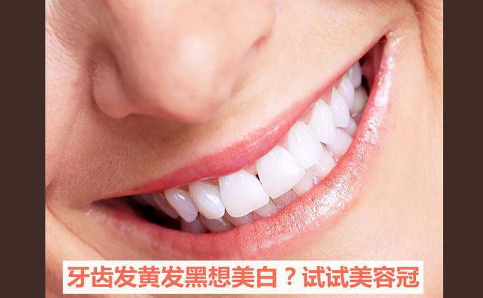 牙齒美容冠大約多少錢？牙齒美容冠怎么做的？