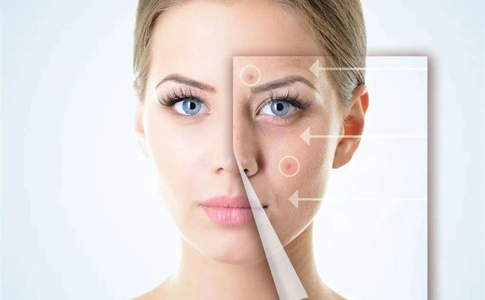 光子嫩膚一般做幾次?