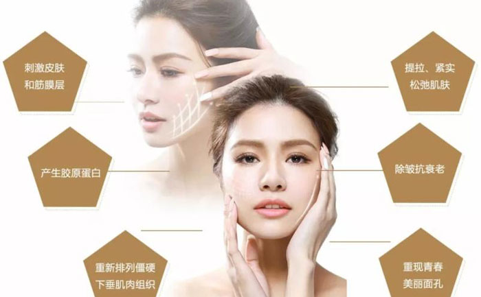 微整形面部提升價格多少？微整形面部提升能保持多久？