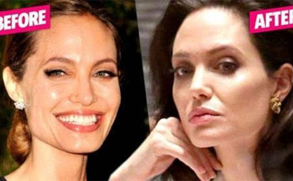 【整容教程篇】想要改善面部輪廓線條應(yīng)該從哪個(gè)部位下手?