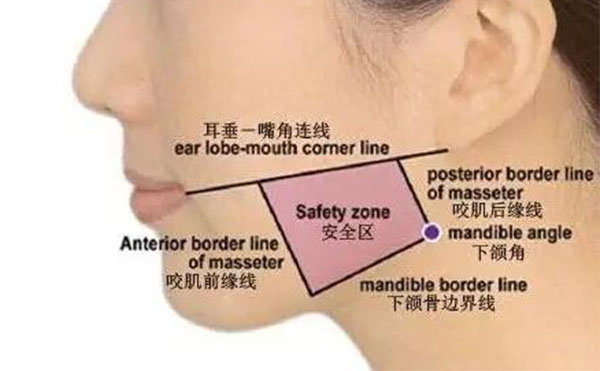 怎樣避免注射瘦臉針后出現(xiàn)副作用?