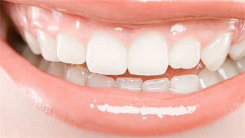 虎牙矯正需要多久？