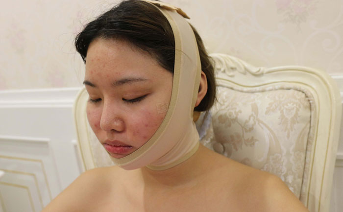 面部吸脂修復(fù)手術(shù)多少錢？面部吸脂會(huì)反彈嗎？