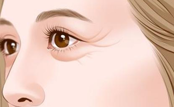 激光去眼袋和手術去眼袋哪個好?有什么優(yōu)勢?