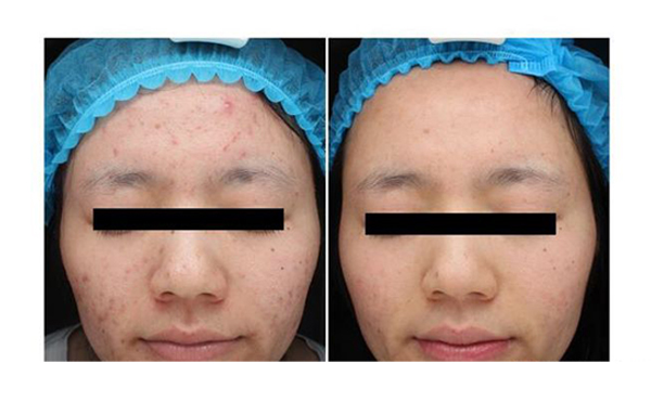 復(fù)合彩光安全嗎？