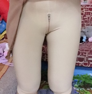 大腿吸脂恢復期