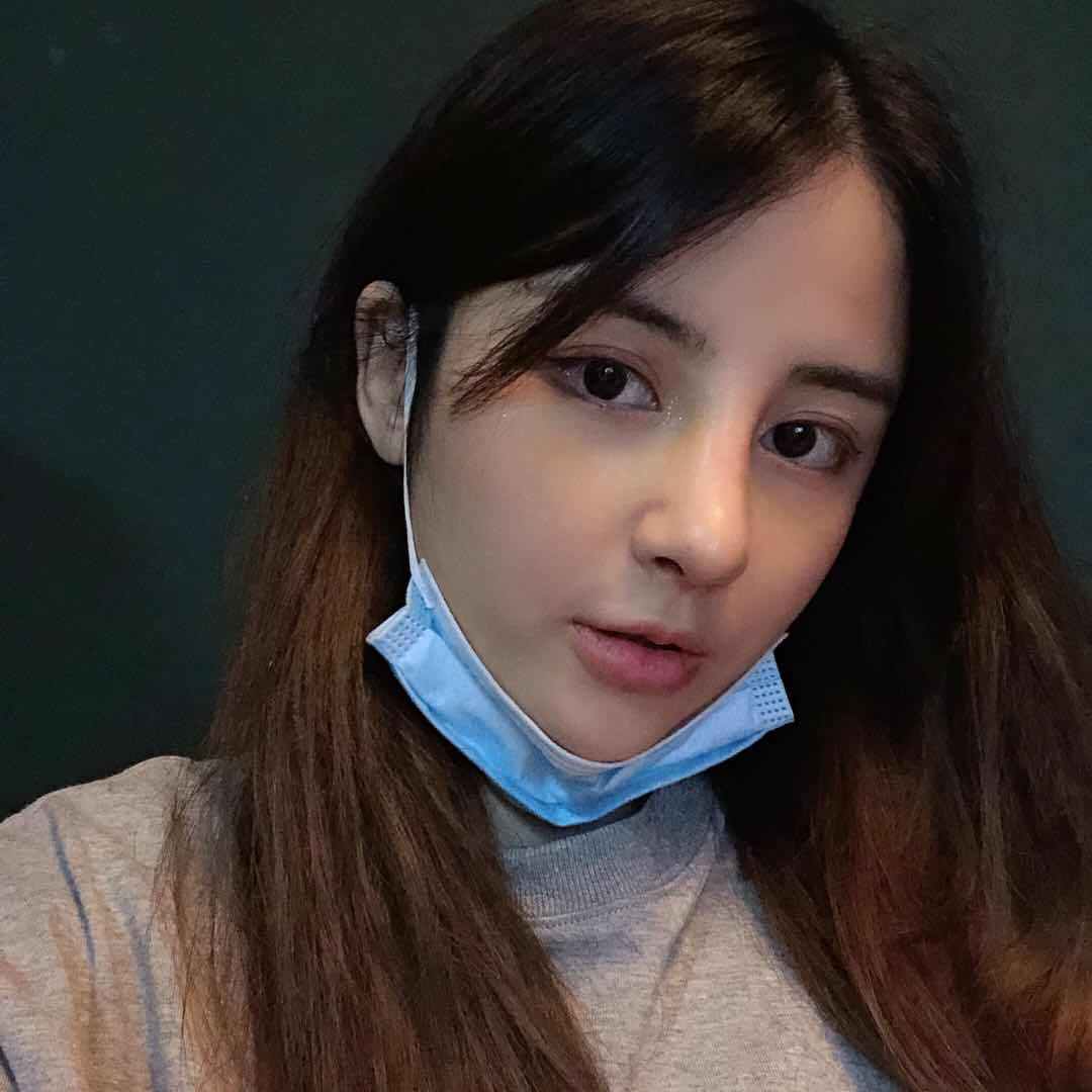 隆鼻手術術后效果