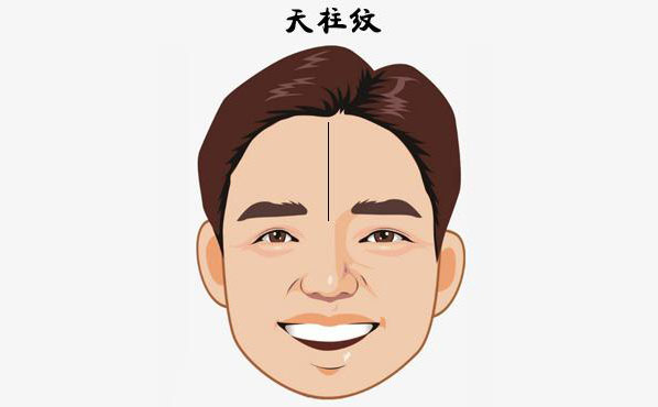 硅膠填充額頭安全嗎？