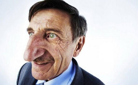 大鼻頭如何變小？鼻頭大怎么改善？