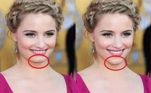 下巴美學標準是什么？