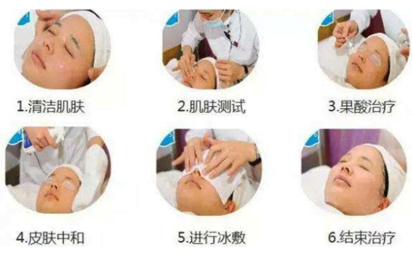 果酸煥膚的過程是什么？