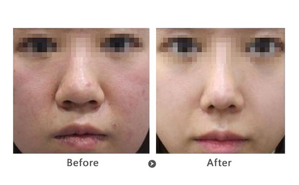 做黑臉娃娃前要注意什么？