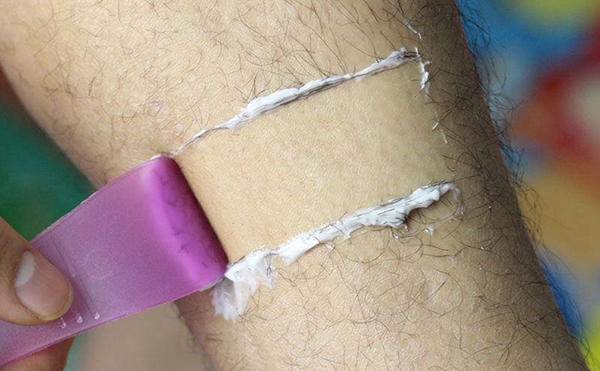 脫腋毛方法有哪些?怎么選擇合適的?