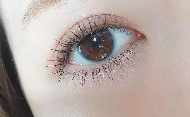 激光雙眼皮手術(shù)多少錢？激光雙眼皮手術(shù)需要多久恢復(fù)時(shí)間？