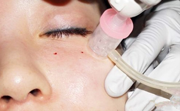 水光針和皮秒哪個(gè)好？