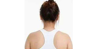 隔空溶脂瘦肩部術(shù)前