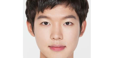 歪鼻矯正術(shù)前