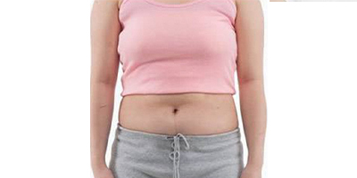 動(dòng)氧瘦腹部術(shù)前