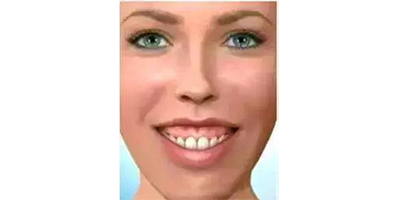 頜面正畸術(shù)前