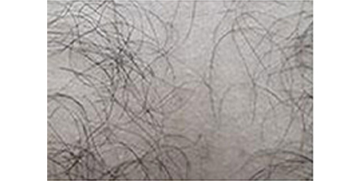 種植私密毛發(fā)術前