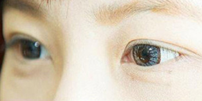 接睫毛術(shù)前