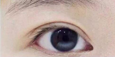 半永久睫毛線術(shù)前