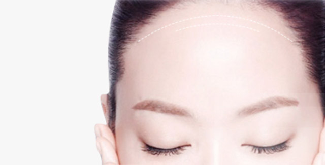 自體脂肪豐額頭效果怎么樣？自體脂肪豐額頭效果可以保持多久？