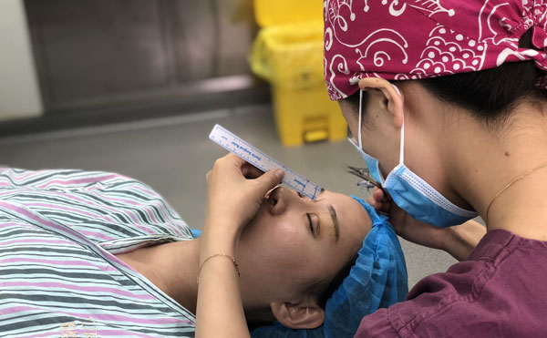 超體隆鼻怎么樣，能保持多久？超體隆鼻可能出現(xiàn)的副作用有哪些？