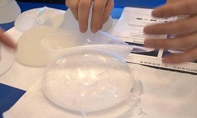 假體隆胸多少錢大概？假體隆胸多久能變軟？