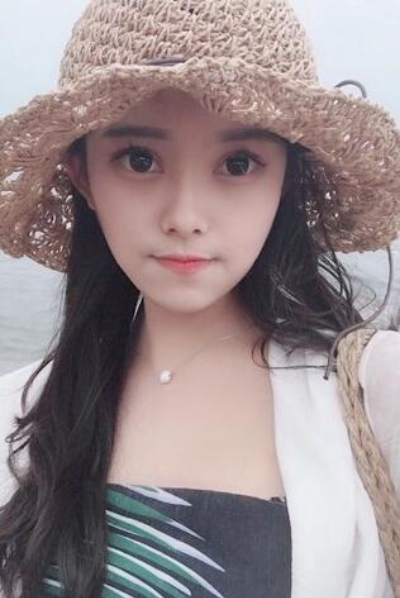 上海新健威醫(yī)療美容門診部做雙眼皮手術(shù)后三天的情況