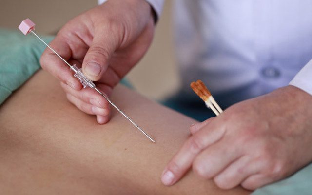 埋線(xiàn)減肥多少錢(qián)一次？埋線(xiàn)減肥多久才能有效果