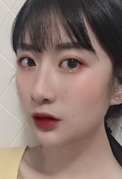 珠海陸達(dá)美容外科醫(yī)院做下頜角術(shù)后效果恢復(fù)的很好 珠海陸達(dá)美容外科醫(yī)院做下頜角術(shù)后效果恢復(fù)的很好