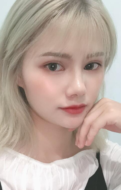 長春亞韓醫(yī)學(xué)美容醫(yī)院做面部吸脂手術(shù)后的臉部 長春亞韓醫(yī)學(xué)美容醫(yī)院做面部吸脂手術(shù)后的臉部