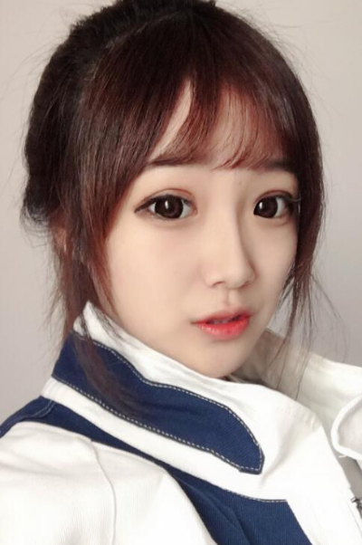 蘇州愛思特醫(yī)療美容醫(yī)院做隆鼻手術后的鼻子狀態(tài) 蘇州愛思特醫(yī)療美容醫(yī)院做隆鼻手術后的鼻子狀態(tài)