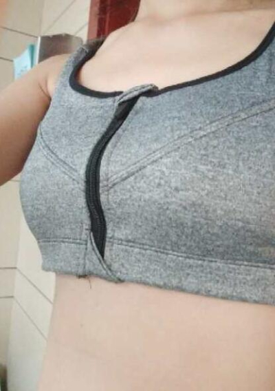 上海美萊醫(yī)療美容門診部做隆胸手術(shù)后一個(gè)月的情況 上海美萊醫(yī)療美容門診部做隆胸手術(shù)后一個(gè)月的情況