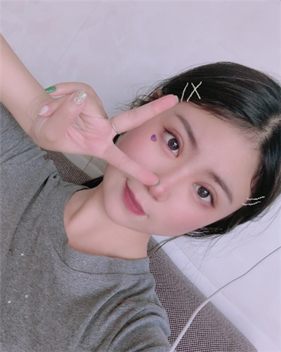 溫州友好醫(yī)院整形美容中心做雙眼皮手術的一周后 溫州友好醫(yī)院整形美容中心做雙眼皮手術的一周后