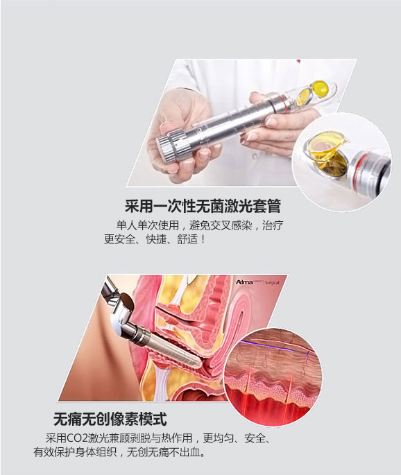 成都愛爾麗整形激光緊縮陰道怎么樣？激光緊縮陰道注意什么？