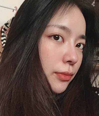 成都漢密爾頓美容醫(yī)院做鼻修復(fù)術(shù)后的日常情況