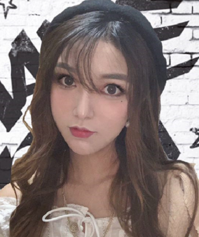 寧波尚美整形美容醫(yī)院做隆鼻手術(shù)的最終效果