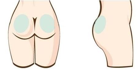 成都大華韓藝做臀部吸脂減肥安全性如何有什么特點(diǎn)？