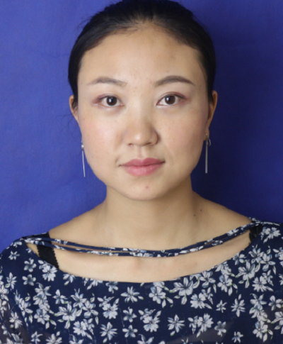 蘇州同濟(jì)醫(yī)院整形美容中心胡慧敏去眼袋案例效果分享