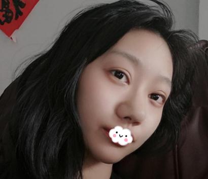 在上海伊美爾港華做假體隆鼻術(shù)前效果