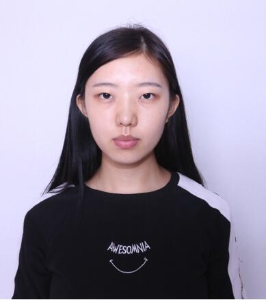 第四軍醫(yī)大學(xué)唐都醫(yī)院李望舟雙眼皮案例術(shù)前