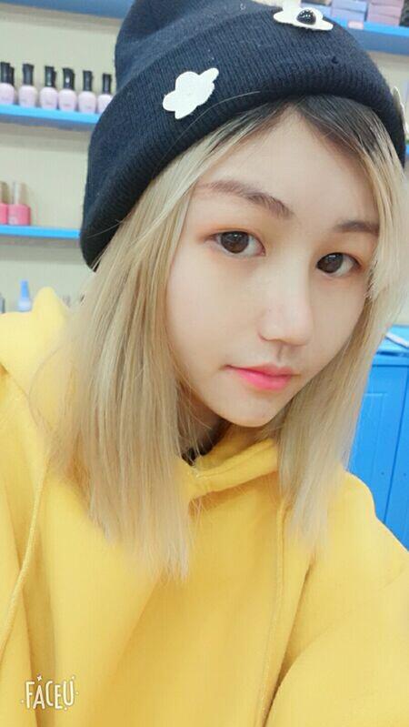 成都蜀尚蓉雅美容整形醫(yī)院做鼻綜合術(shù)后的鼻子恢復(fù)的很不錯