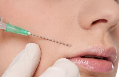 注射填充法令紋的方式有哪些？如何通過(guò)醫(yī)美手段祛法令紋？