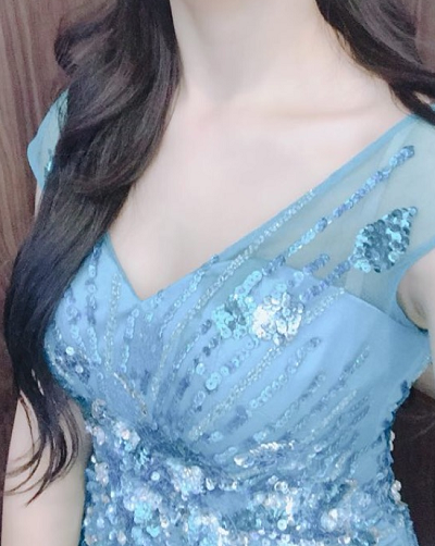  北京藝星醫(yī)療美容醫(yī)院做自體脂肪隆胸手術(shù)后的胸部